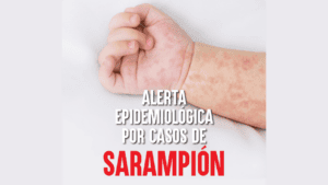 Hasta el lunes 16 de febrero el país reportó 345 casos de sarampión. Sololá y Guatemala son quienes más positivos documentan.